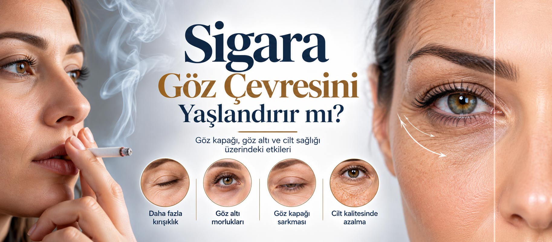 Sigara ve Goz Cevresi Yaslanmasi