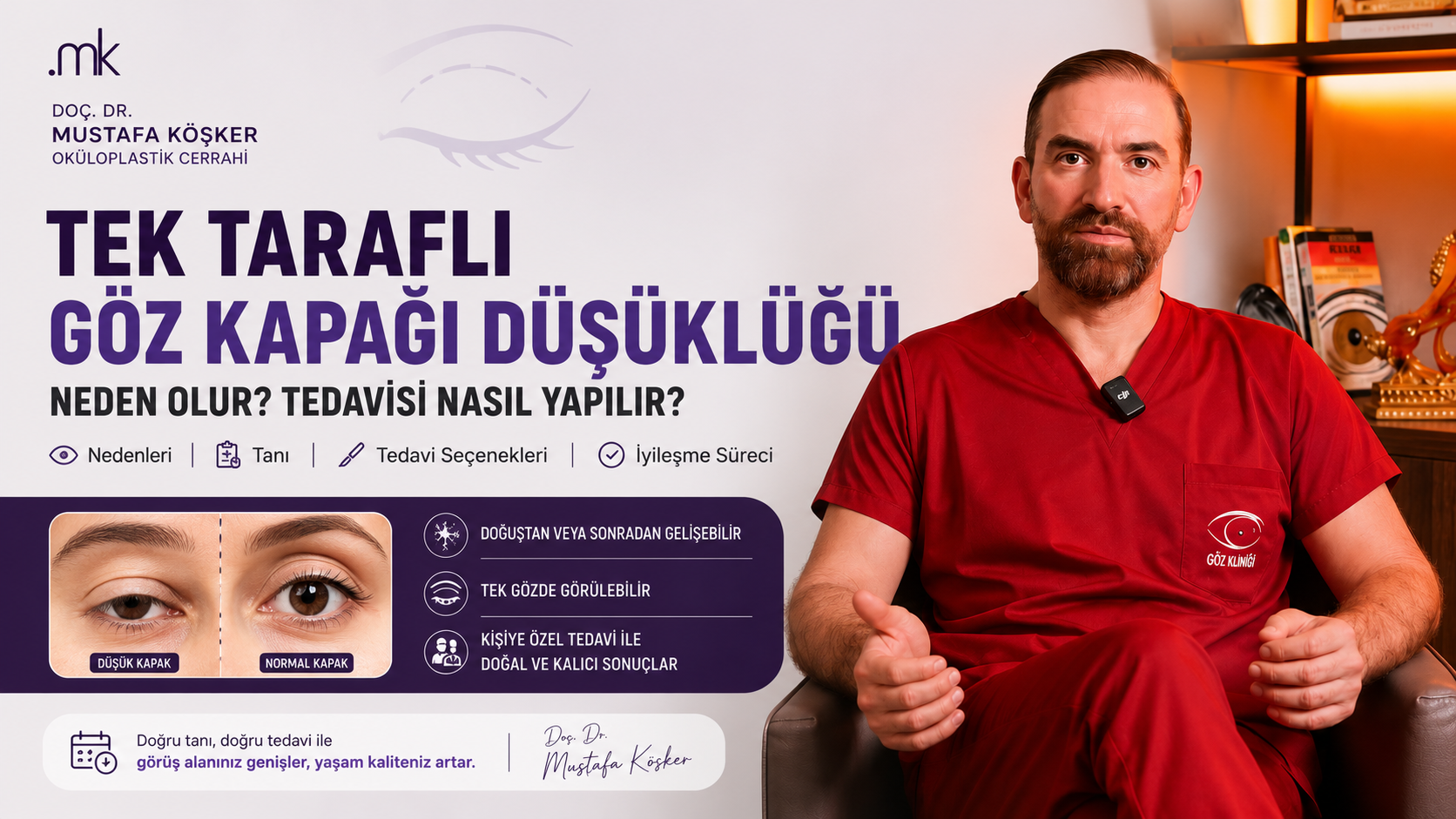 Tek Tarafli Goz Kapagi Dusuklugu Neden Olur Tedavisi Nasil Yapilir