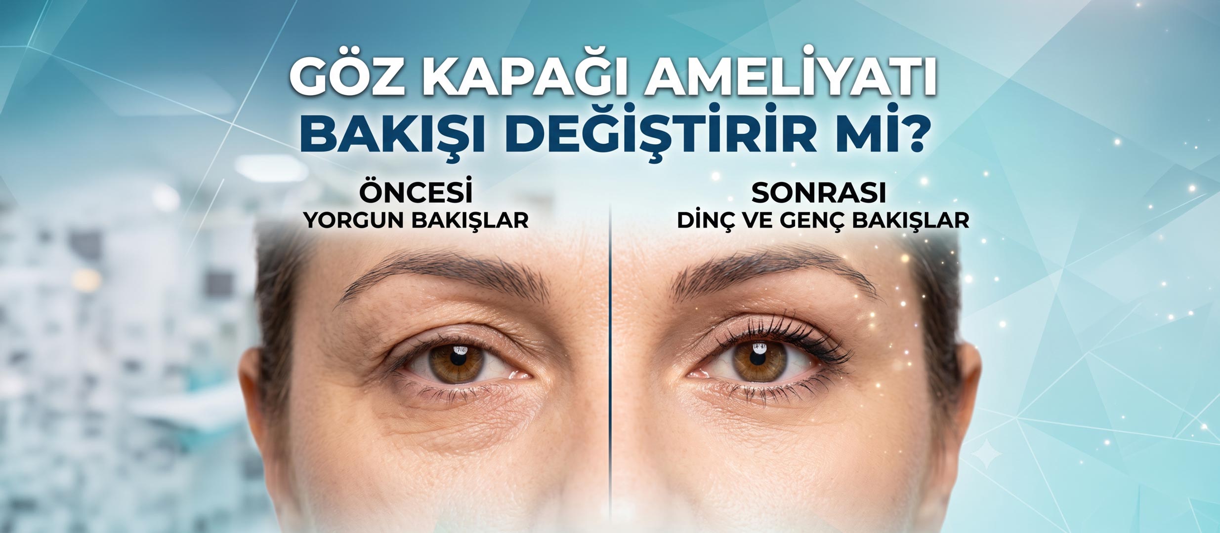 goz kapagi ameliyati bakisi degistirir mi