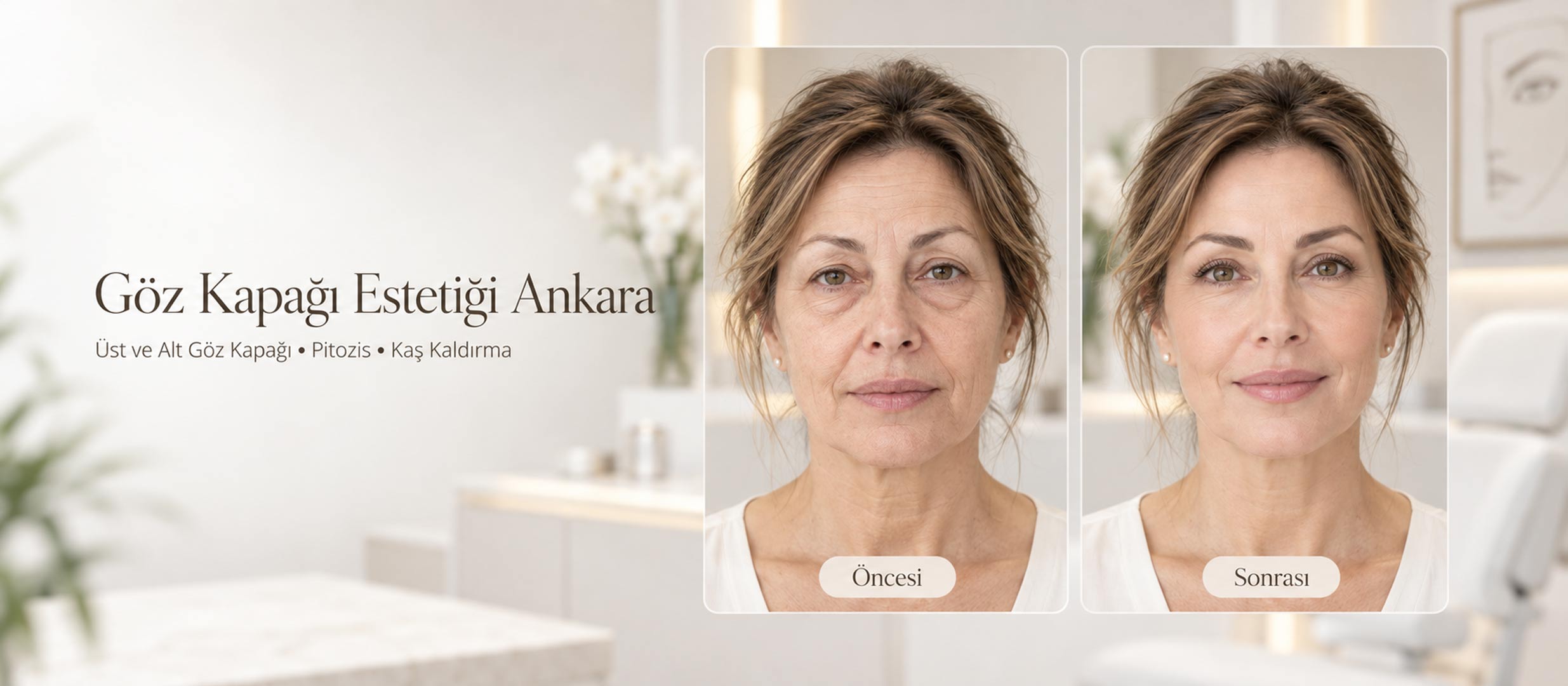 Üst ve Alt Göz Kapağı Ameliyatı, Pitozis, Kaş Kaldırma – Göz Kapağı Estetiği